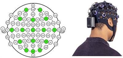 An Automated Approach for the Detection of Alzheimer's Disease From Resting State Electroencephalography